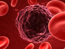 Cancer cell surrounded by red blood cells (Picture: iStockphoto)
