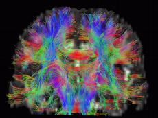 Visualisierung des Kommunikationsnetzwerks in unserem Gehirn (Bild: Peter Bösiger / ETH Zürich)