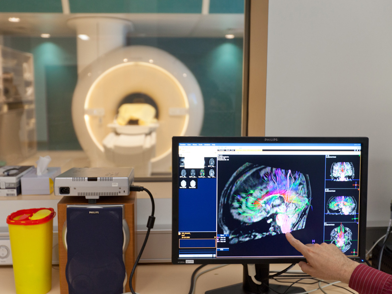 Die Technik macht sichtbar, was ein Chirurge nur dann sieht, wenn er invasiv vorgeht: Blick auf die Nervenverbindungen im Gehirn.