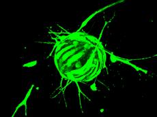 Neues 3D-Zellkultursystem: Lymphgewebezellen bilden auf Mikrokügelchen Zellaussprossungen (Mikroskopiebild). (Bild: Martin Schulz / ETH Zürich / PNAS)