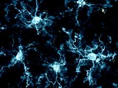 Microglial cells play a key role in the development of schizophrenia. (Photo: Urs Meyer / ETH Zurich)
